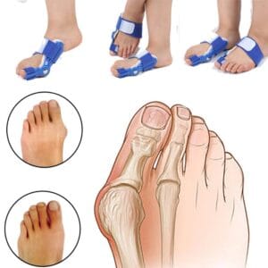 Attelle Hallux Valgus flexible montrant sa conception ergonomique pour un confort optimal jour et nuit sur le pied.